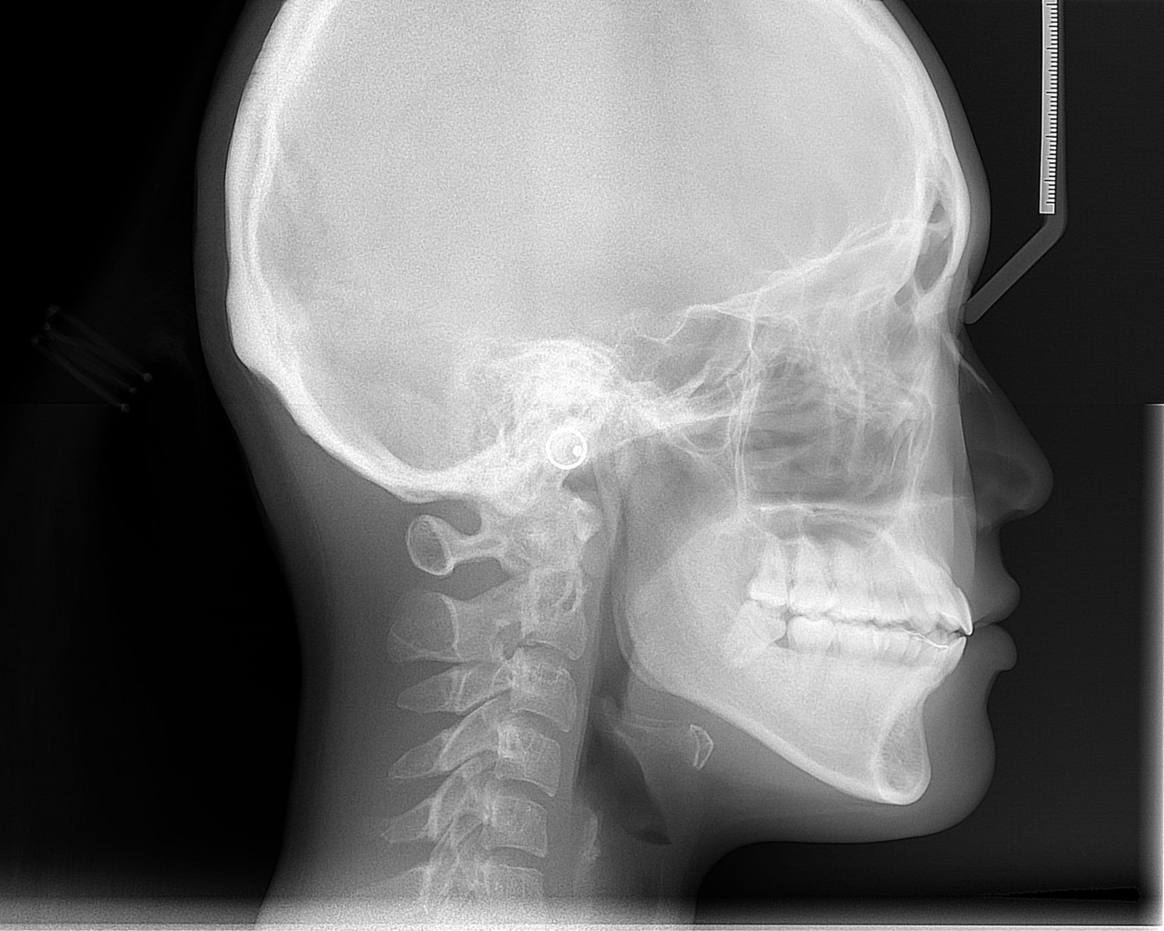 Cephalometric radiograph